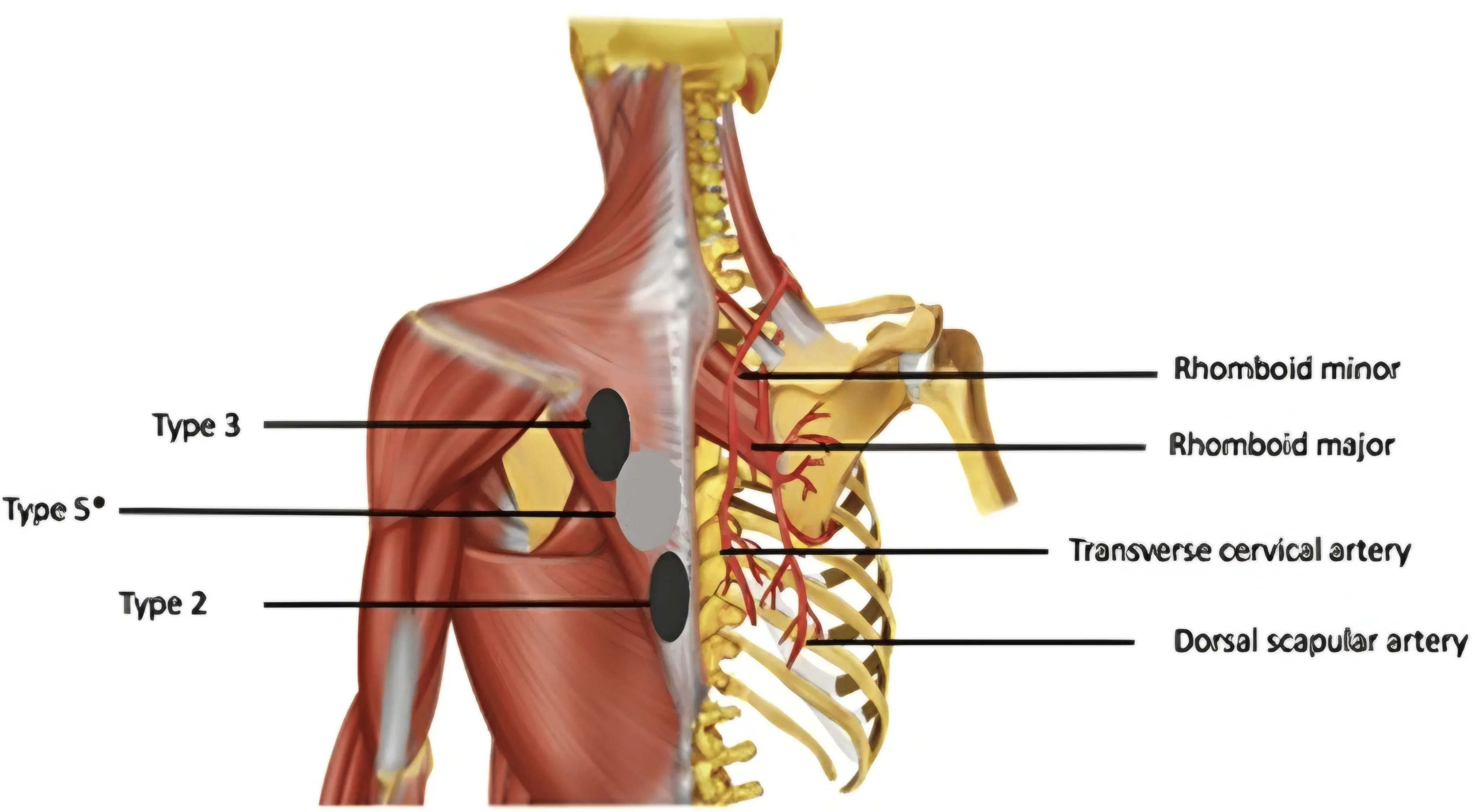 شریان کتفی پشتی (Dorsal Scapular Artery) | خونرسانی به متوازی الاضلاع