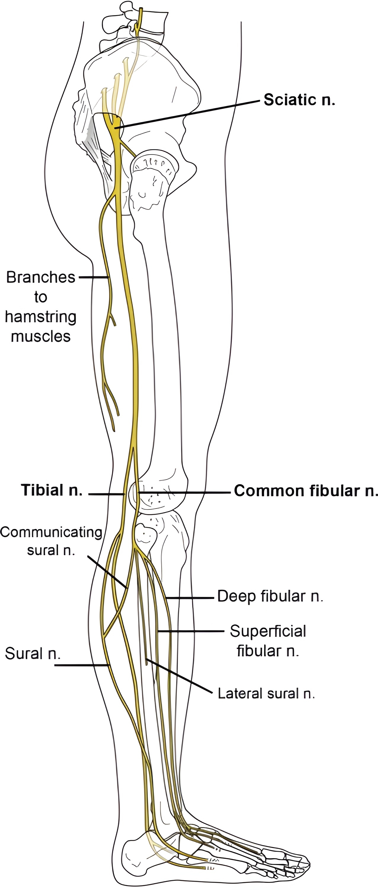 عصب سیاتیک و عضله همسترینگ